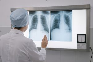 Read more about the article Distributor Alkes Makassar dan Pentingnya X-Ray Film Viewer dalam Penanganan TBC